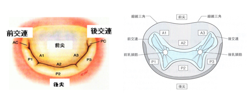 僧帽弁形成術(MVP+MAP)の基本知識